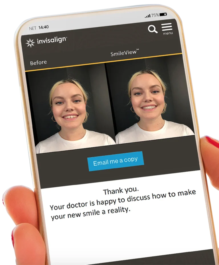 Invisalign 6 Invisalign SmileView before-and-after smile preview displayed on a smartphone for Roots Dental patients.