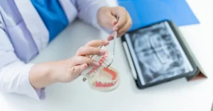 Dentist explaining All-on-X dental implants with model and X-ray at Roots Dental in Bellingham.